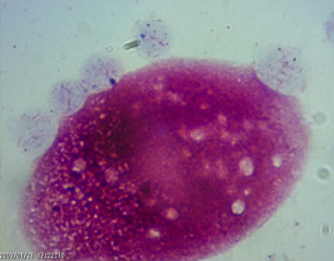 レジオネラが感染したテトラヒメナより放出される小胞ペレット．北条史君(修士過程2年生)が撮影しました．